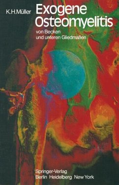 Exogene Osteomyelitis von Becken und unteren Gliedmaßen - Müller, K. H.