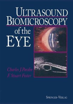 Ultrasound Biomicroscopy of the Eye - Pavlin, Charles J.; Foster, F.Stuart