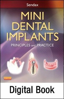 Mini Dental Implants - Elsevier eBook on Vitalsource (Retail Access Card): Principles and Practice - Sendax, Victor