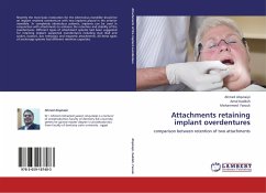 Attachments retaining implant overdentures