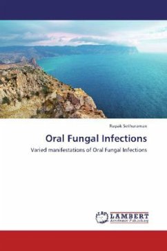 Oral Fungal Infections - Sethuraman, Rupak
