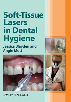 Soft-Tissue Lasers in Dental H - Blayden, Jessica; Mott, Angie