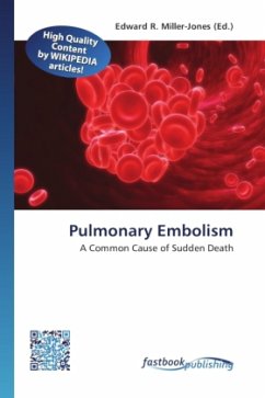 Pulmonary Embolism