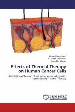 Effects of Thermal Therapy on Human Cancer Cells - Khavaripour, Hesam;Akbari Sheldareh, Ali;Nassiri, Fardokht