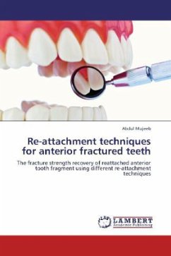 Re-attachment techniques for anterior fractured teeth