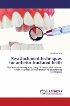 Re-attachment techniques for anterior fractured teeth - Mujeeb, Abdul