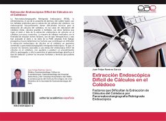 Extracción Endoscópica Difícil de Cálculos en el Colédoco - Ramirez Garcia, Juan Felipe