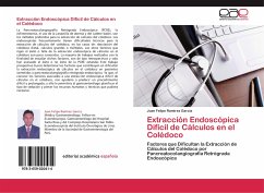 Extracción Endoscópica Difícil de Cálculos en el Colédoco