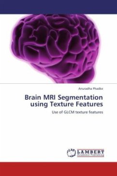 Brain MRI Segmentation using Texture Features