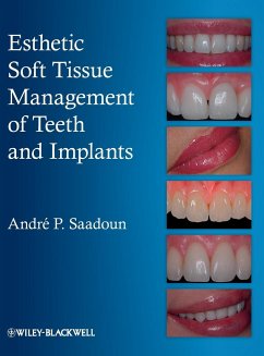 Esthetic Soft Tissue Management of Teeth and Implants - Saadoun, Andre P.