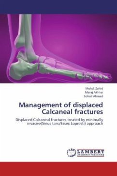 Management of displaced Calcaneal fractures - Zahid, Mohd.;Akhter, Meraj;Ahmad, Sohail