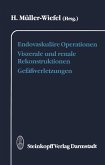 Endovaskuläre Operationen Viszerale und renale Rekonstruktionen Gefäßverletzungen