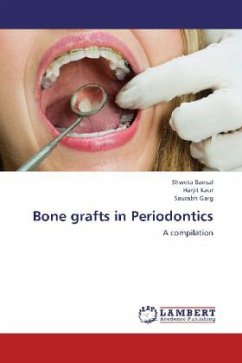 Bone grafts in Periodontics - Bansal, Shweta;Kaur, Harjit;Garg, Saurabh