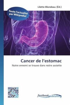 Cover Cancer de l estomac