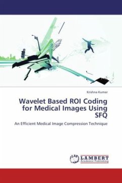Wavelet Based ROI Coding for Medical Images Using SFQ