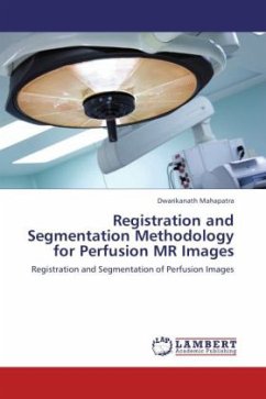 Registration and Segmentation Methodology for Perfusion MR Images