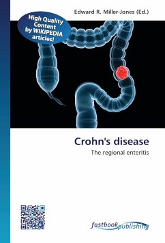 Crohn's disease