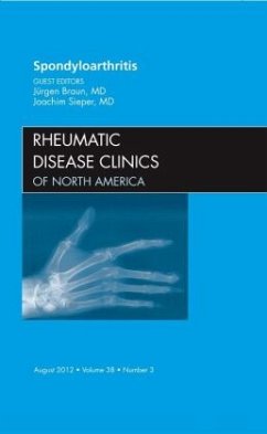 Spondyloarthropathies, An Issue of Rheumatic Disease Clinics - Braun, Juergen;Sieper, Joachim