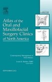 Contemporary Management of Third Molars, an Issue of Atlas of the Oral and Maxillofacial Surgery Clinics