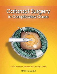 Cataract Surgery in Complicated Cases - Buratto, Lucio; Brint, Stephen; Caretti, Luigi