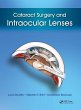 Cataract Surgery and Intraocular Lenses - Bild 1