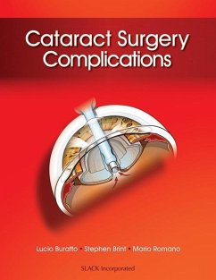 Cataract Surgery Complications - Buratto, Lucio; Brint, Stephen; Romano, Mario