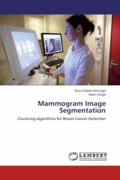 Mammogram Image Segmentation