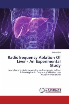 Radiofrequency Ablation Of Liver - An Experimental Study