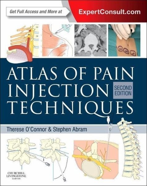 Atlas of Pain Injection Techniques Atlas of Pain Injection Techniques
