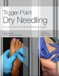 Trigger Point Dry Needling - Bild 1