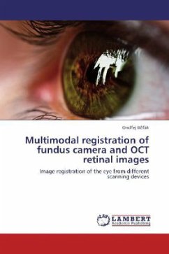 Multimodal registration of fundus camera and OCT retinal images