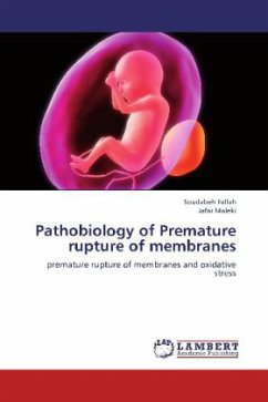 Pathobiology of Premature rupture of membranes - Fallah, Soudabeh;Maleki, Jafar