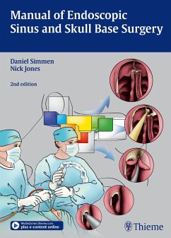 Manual of Endoscopic Sinus and Skull Base Surgery - Simmen, Daniel; Jones, Nick