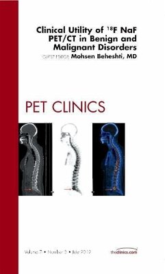 Clinical Utility of 18NaF PET/CT in Benign and Malignant Disorders, An Issue of PET Clinics - Beheshti, Mohsen