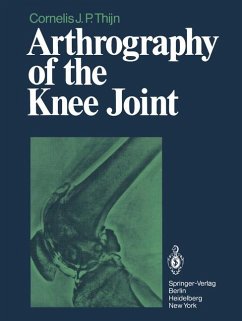 Arthrography of the knee joint