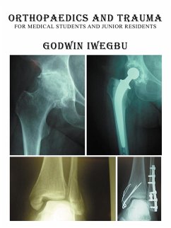Orthopaedics and Trauma for Medical Students and Junior Residents - Iwegbu, Godwin