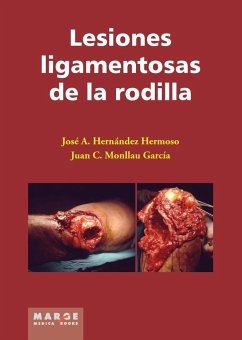 Lesiones ligamentosas de la rodilla - Hernández Hermoso, José Antonio; Monllau García, Juan C