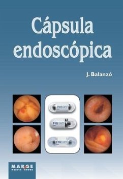 Cápsula endoscópica - Balanzó Tintoré, Joaquim