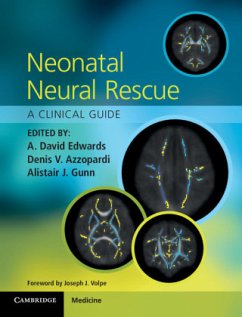 Neonatal Neural Rescue: A Clinical Guide