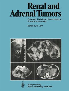 Renal and Adrenal Tumors Pathology, Radiology, Ultrasonography, Therapy, Immunology - Löhr, E., R. Ackerman and D. Bachmann