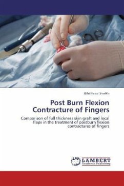 Post Burn Flexion Contracture of Fingers