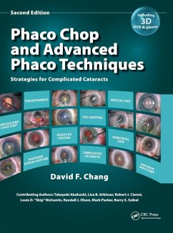 Cover Phaco Chop and Advanced Phaco Techniques