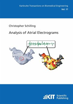 Analysis of Atrial Electrograms