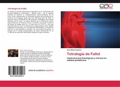 Tetralogía de Fallot