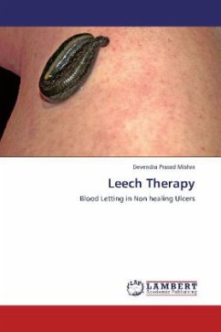 Leech Therapy