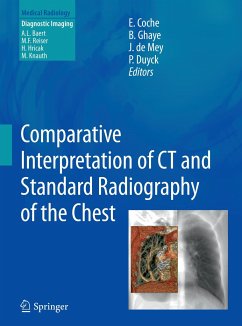 Comparative Interpretation of CT and Standard Radiography of the Chest