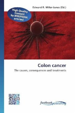 Colon cancer