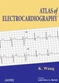 Atlas of Electrocardiography Atlas of Electrocardiography