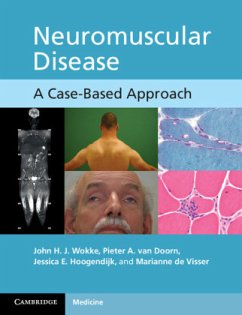 Neuromuscular Disease: A Case-Based Approach - Wokke, John H. J.; Doorn, Pieter A. van; Hoogendijk, Jessica E.