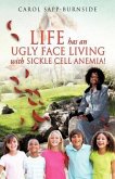Life Has an Ugly Face Living with Sickle Cell Anemia!